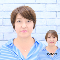 更年期障害による薄毛は深刻。育毛の効果が表れにくい？